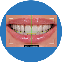 smile Digital Design cosmetic dentist wakad hinjewadi